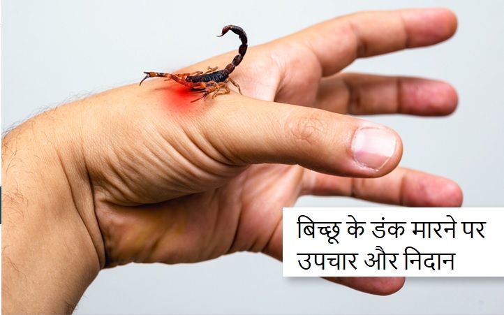 बिच्छू के डंक का घरेलू इलाज